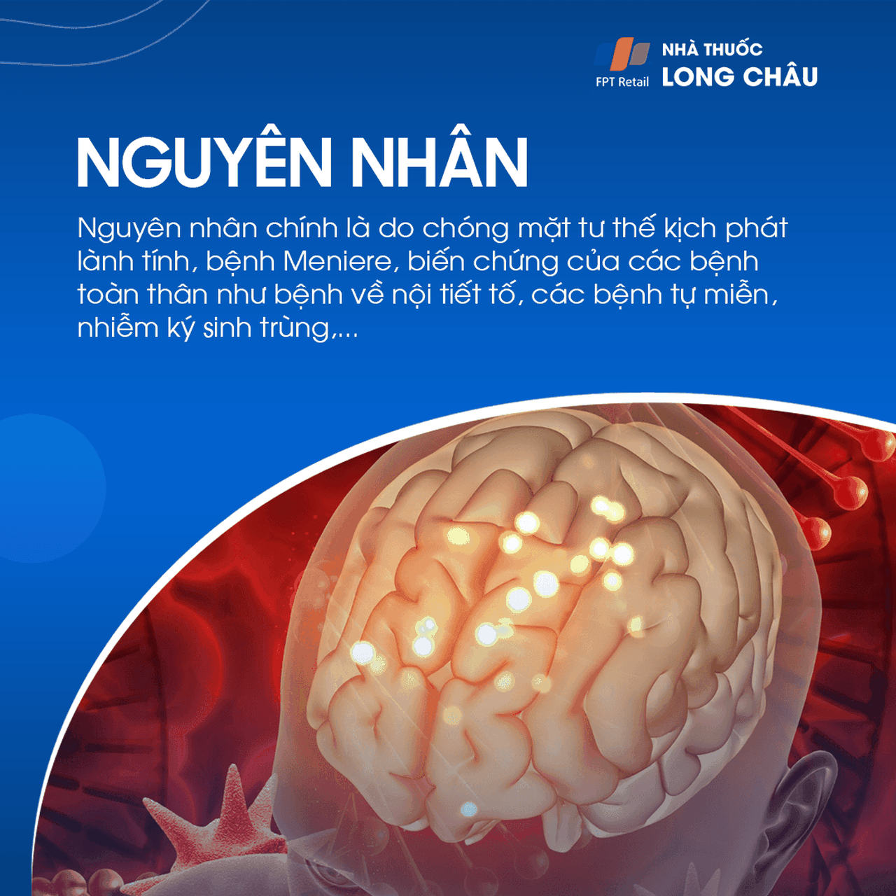 Rối loạn tiền đình ngoại biên 3