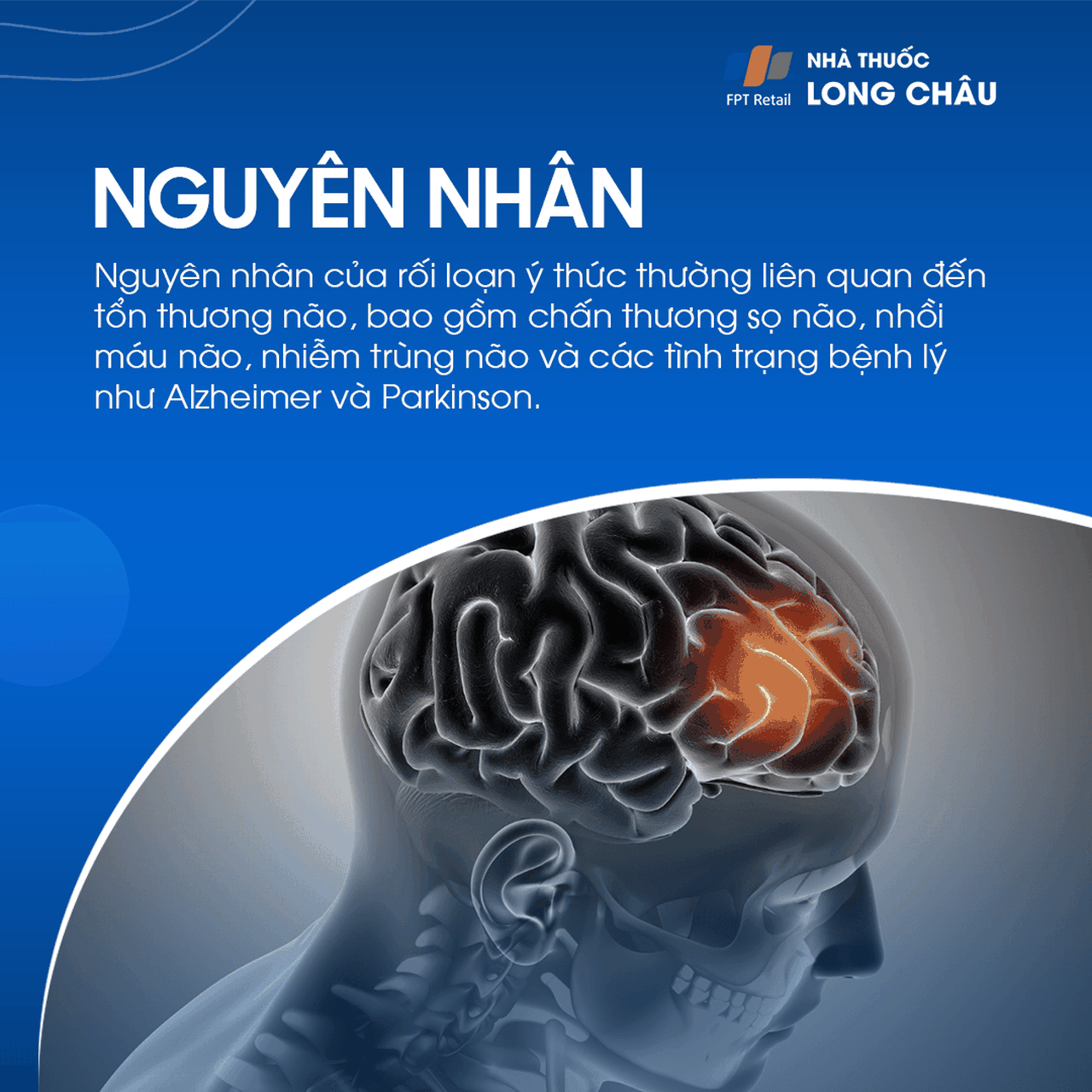 Rối loạn ý thức 3