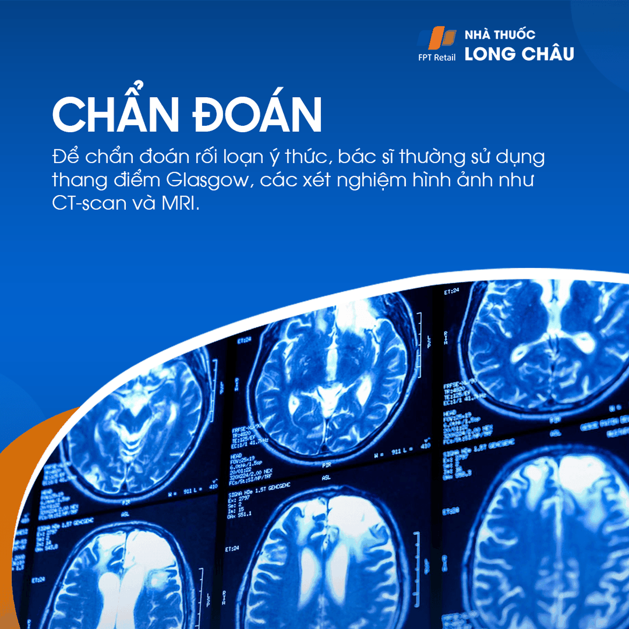 Rối loạn ý thức 5