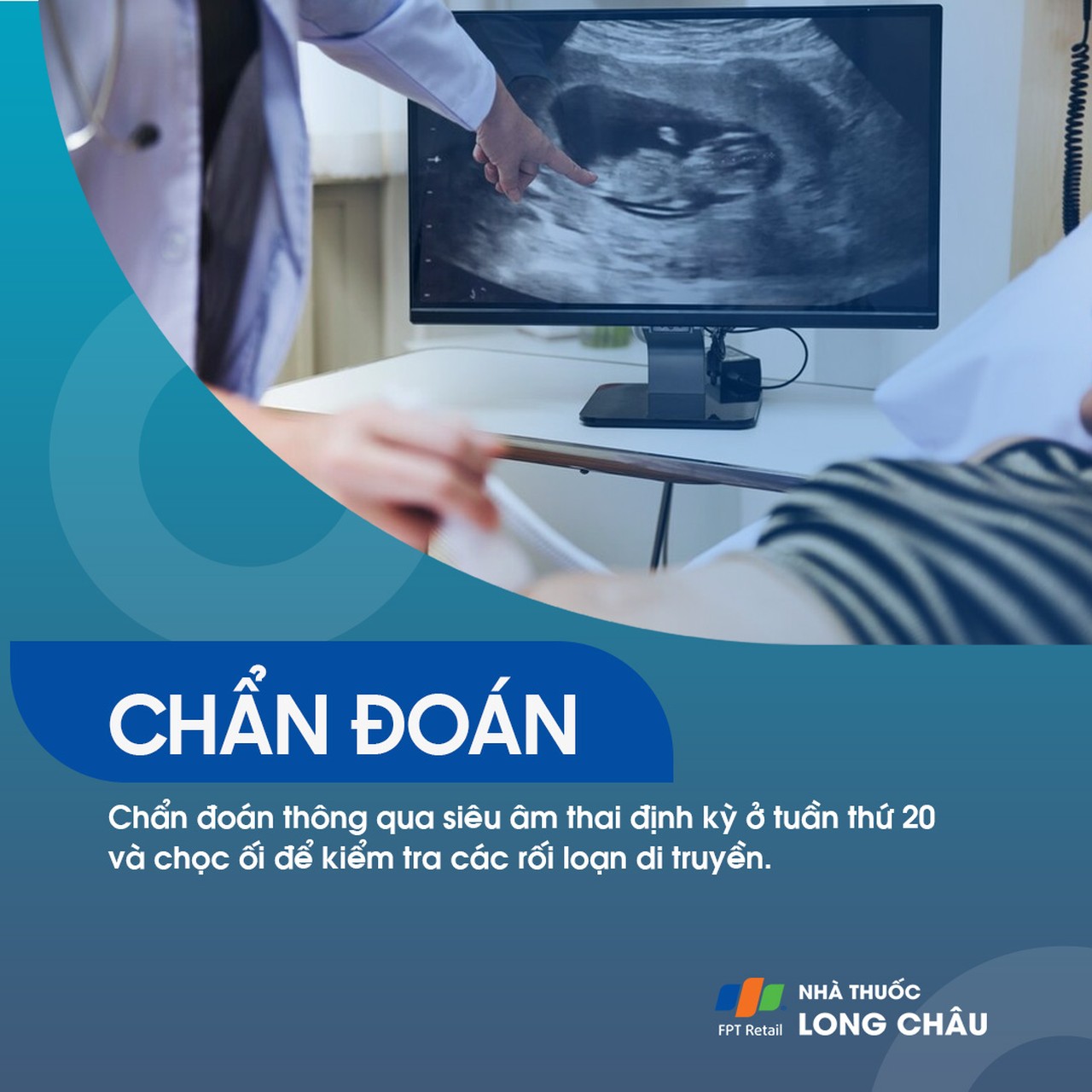 Sứt môi và hở hàm ếch 5