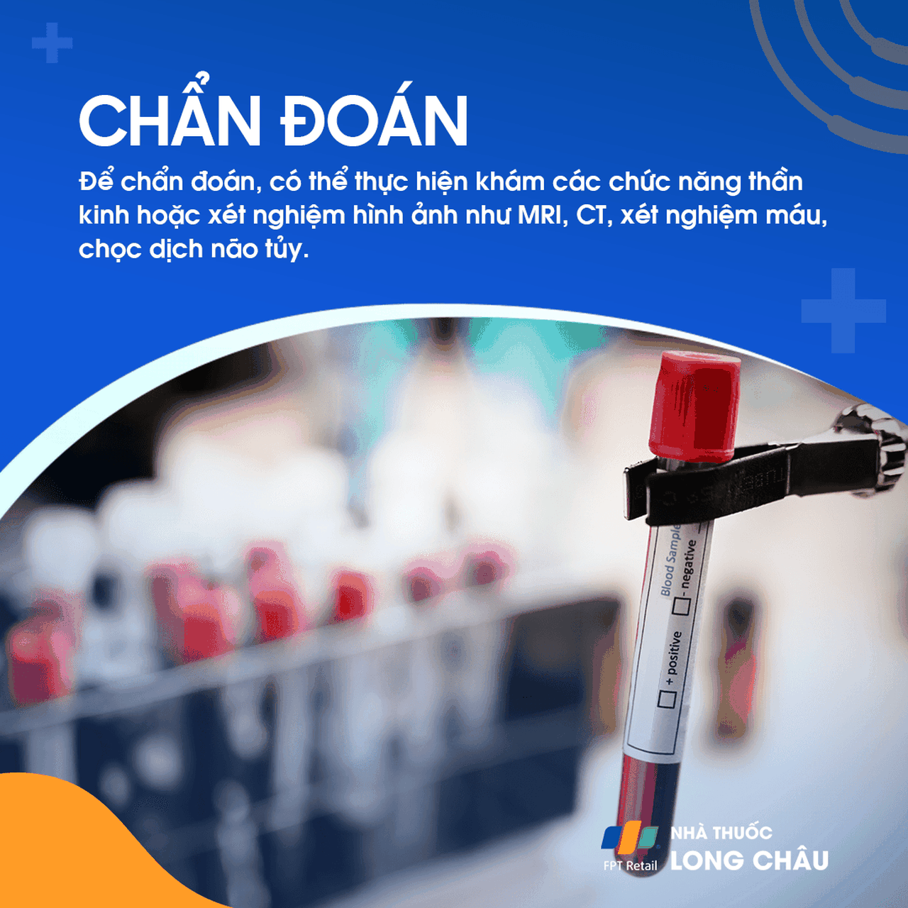 Thoái hóa tiểu não 5