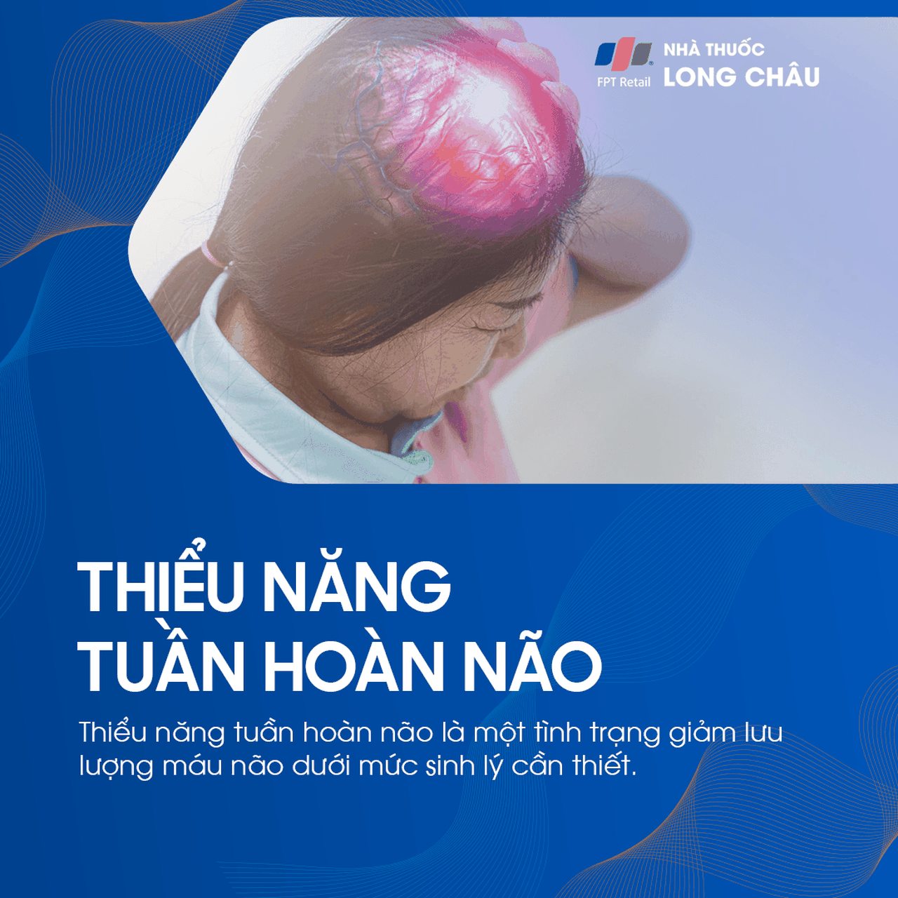 Thiểu năng tuần hoàn não 1