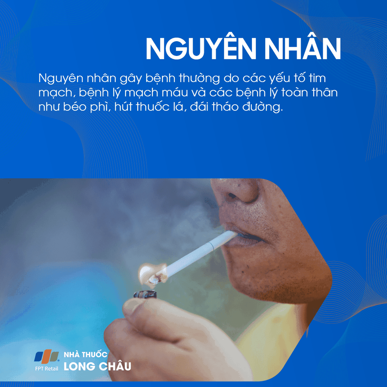Thiểu năng tuần hoàn não 3