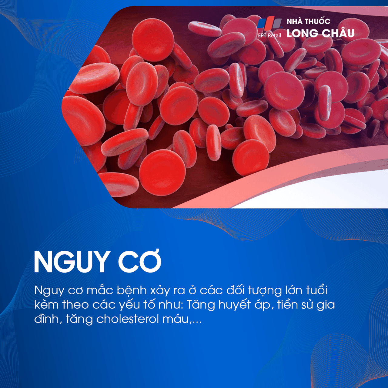 Thiểu năng tuần hoàn não 4