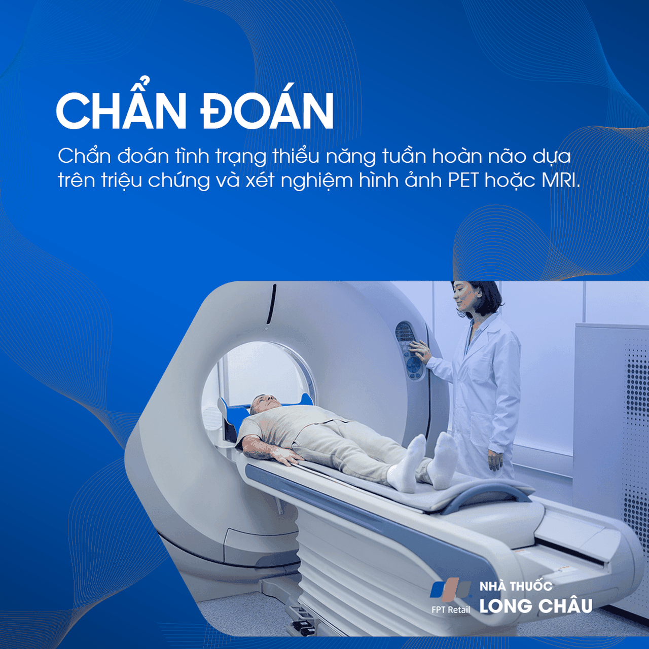 Thiểu năng tuần hoàn não 5