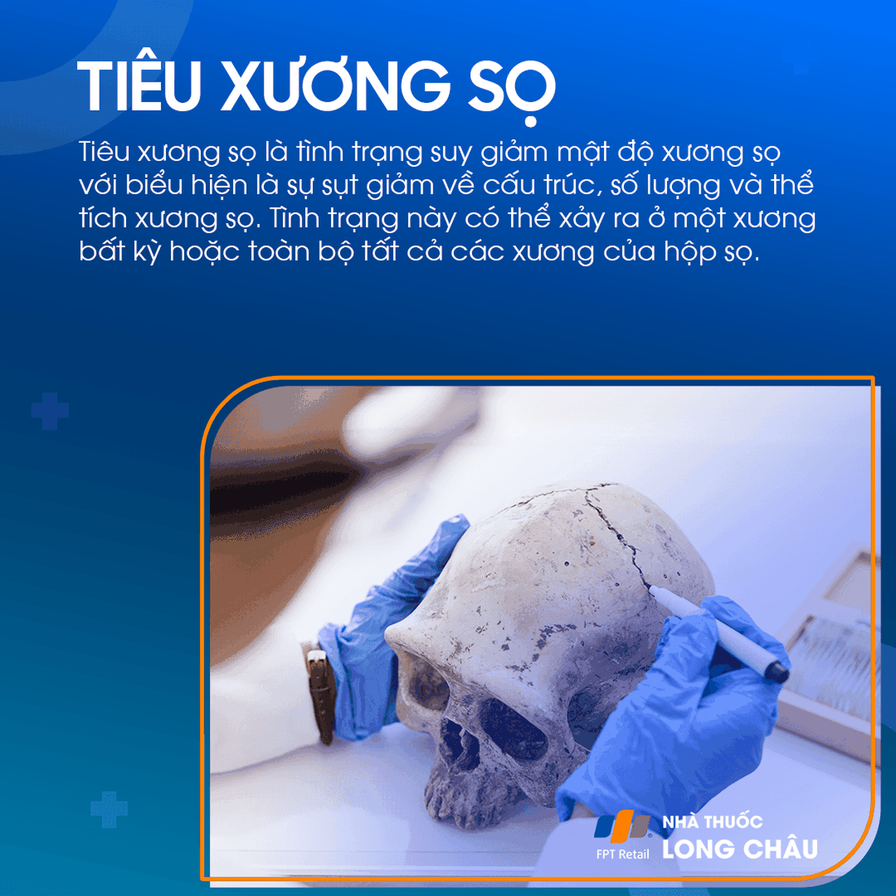 Tiêu xương sọ 1