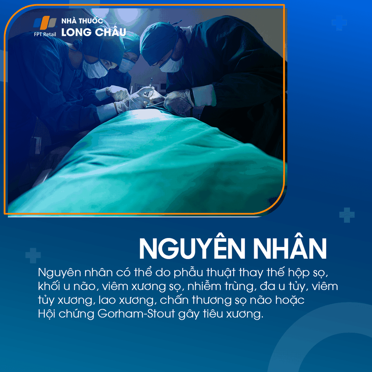 Tiêu xương sọ 3