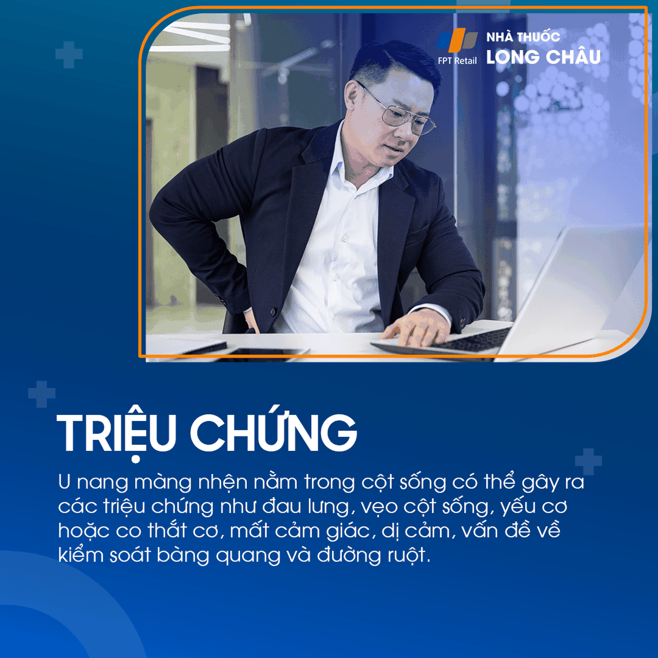 U nang màng nhện não 3