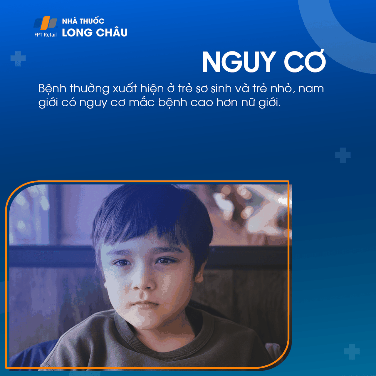 U nang màng nhện não 5