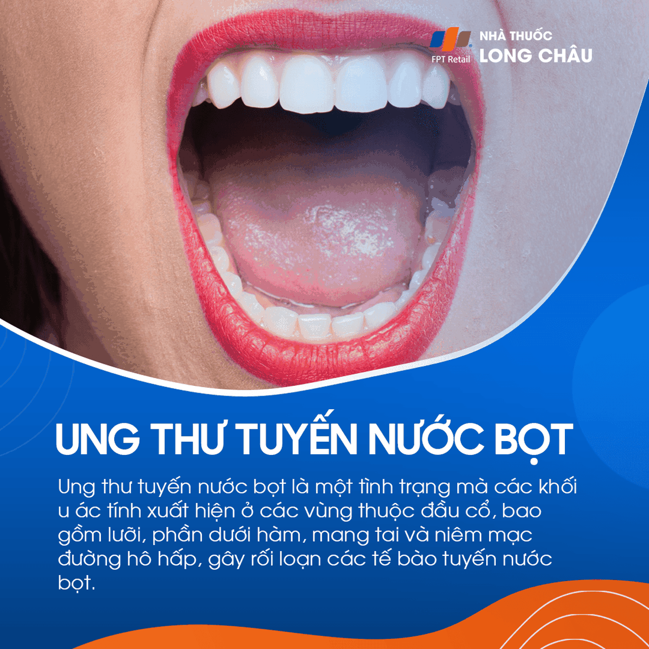 Ung thư tuyến nước bọt 1