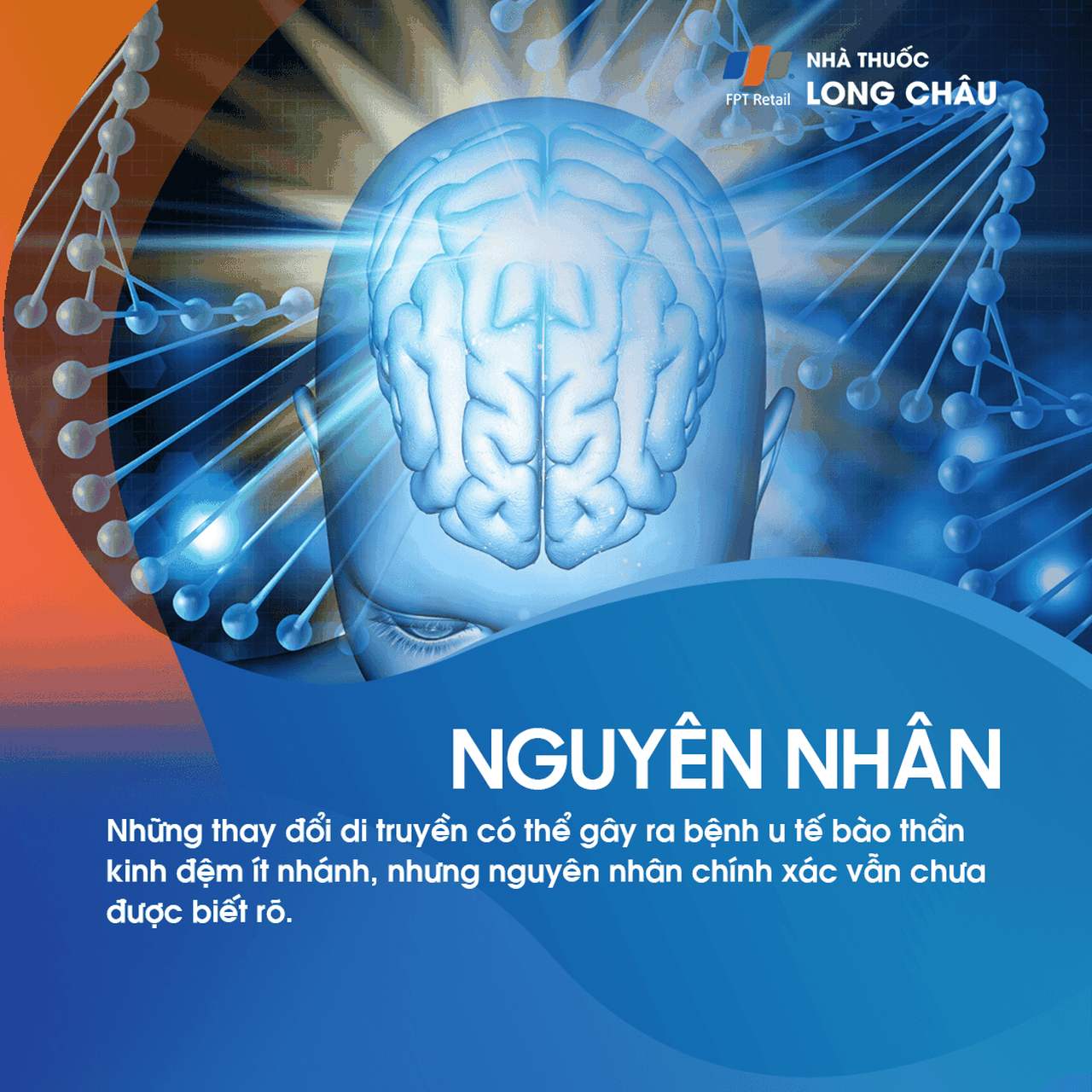 U tế bào thần kinh đệm ít nhánh 3