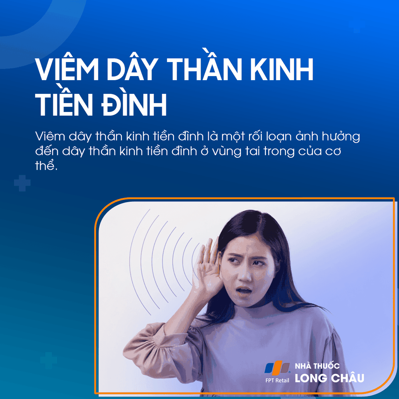 Viêm dây thần kinh tiền đình 1