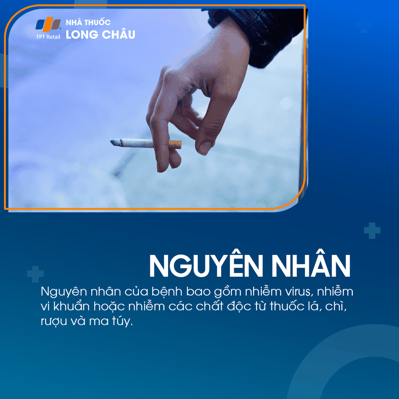 Viêm dây thần kinh tiền đình 3