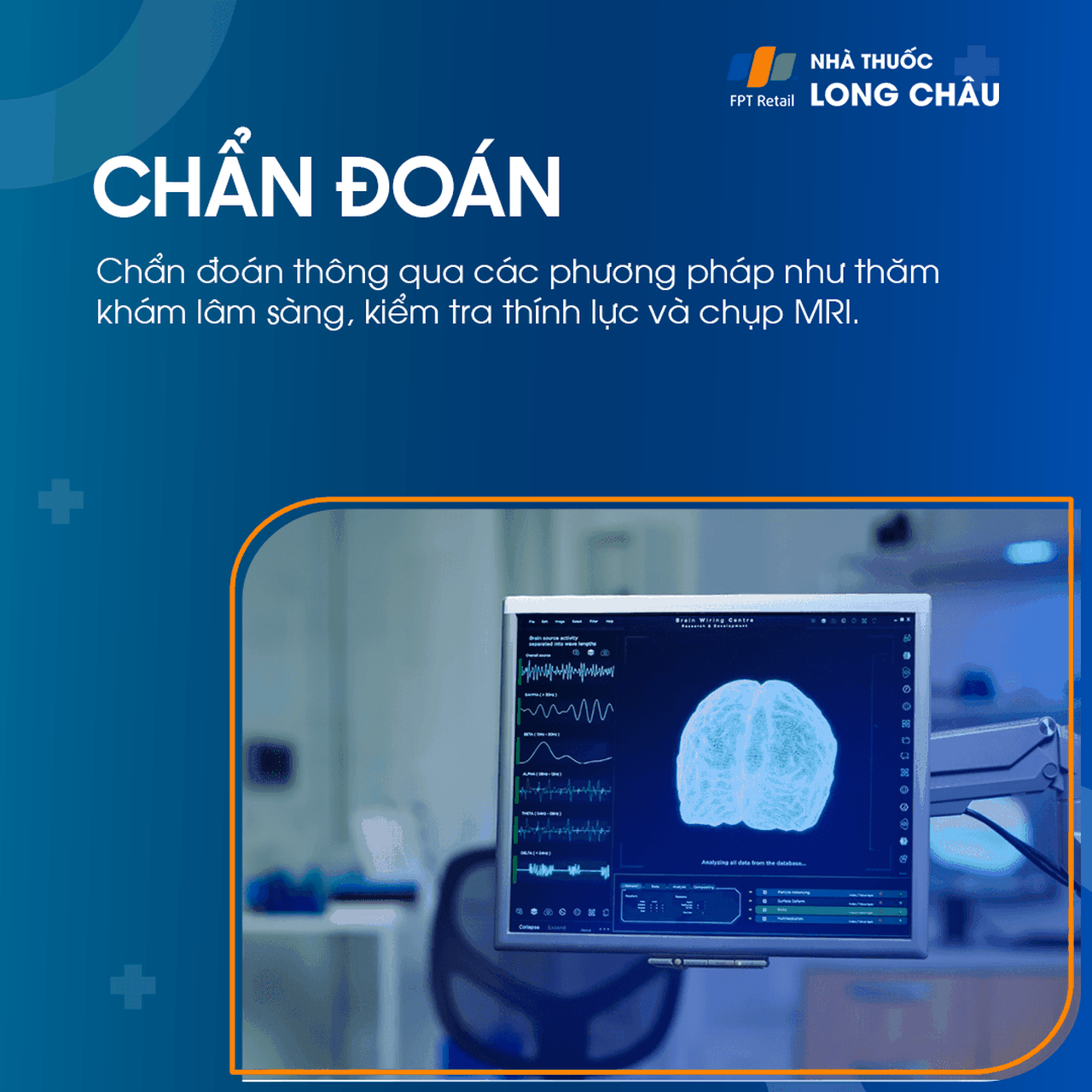 Viêm dây thần kinh tiền đình 5