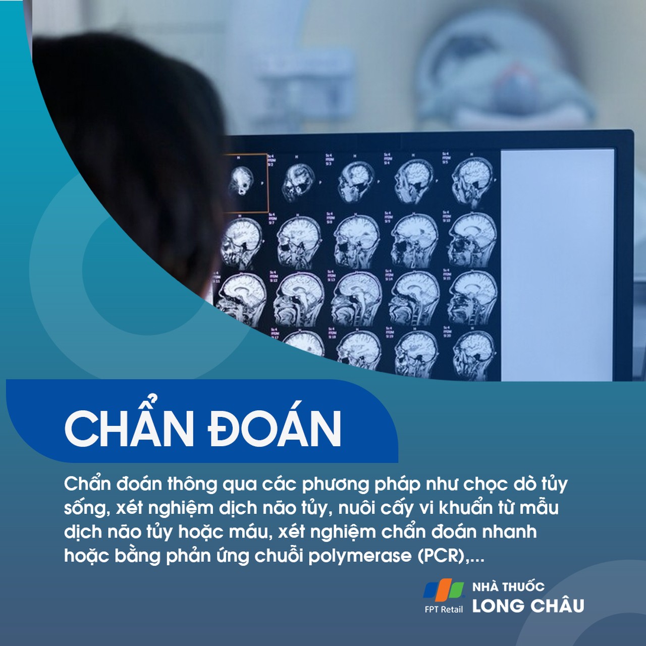 Viêm màng não mủ 6