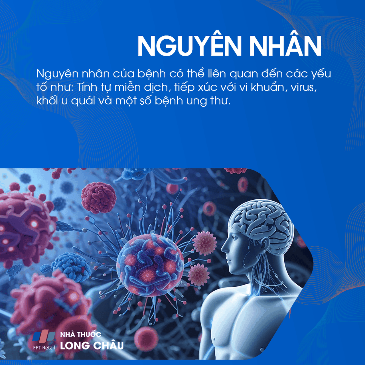 Viêm não tụ miễn 3