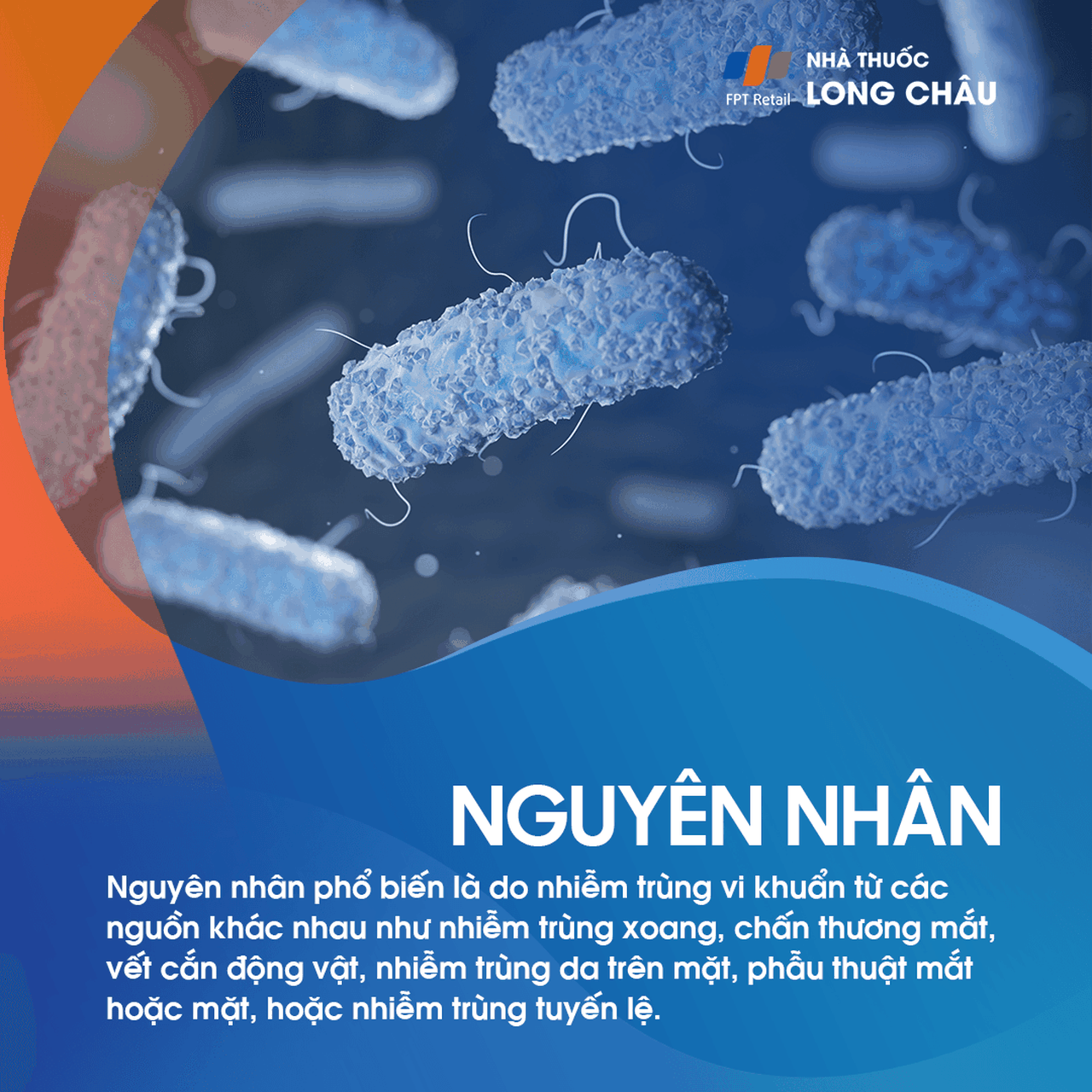 Viêm tổ chức hốc mắt 3