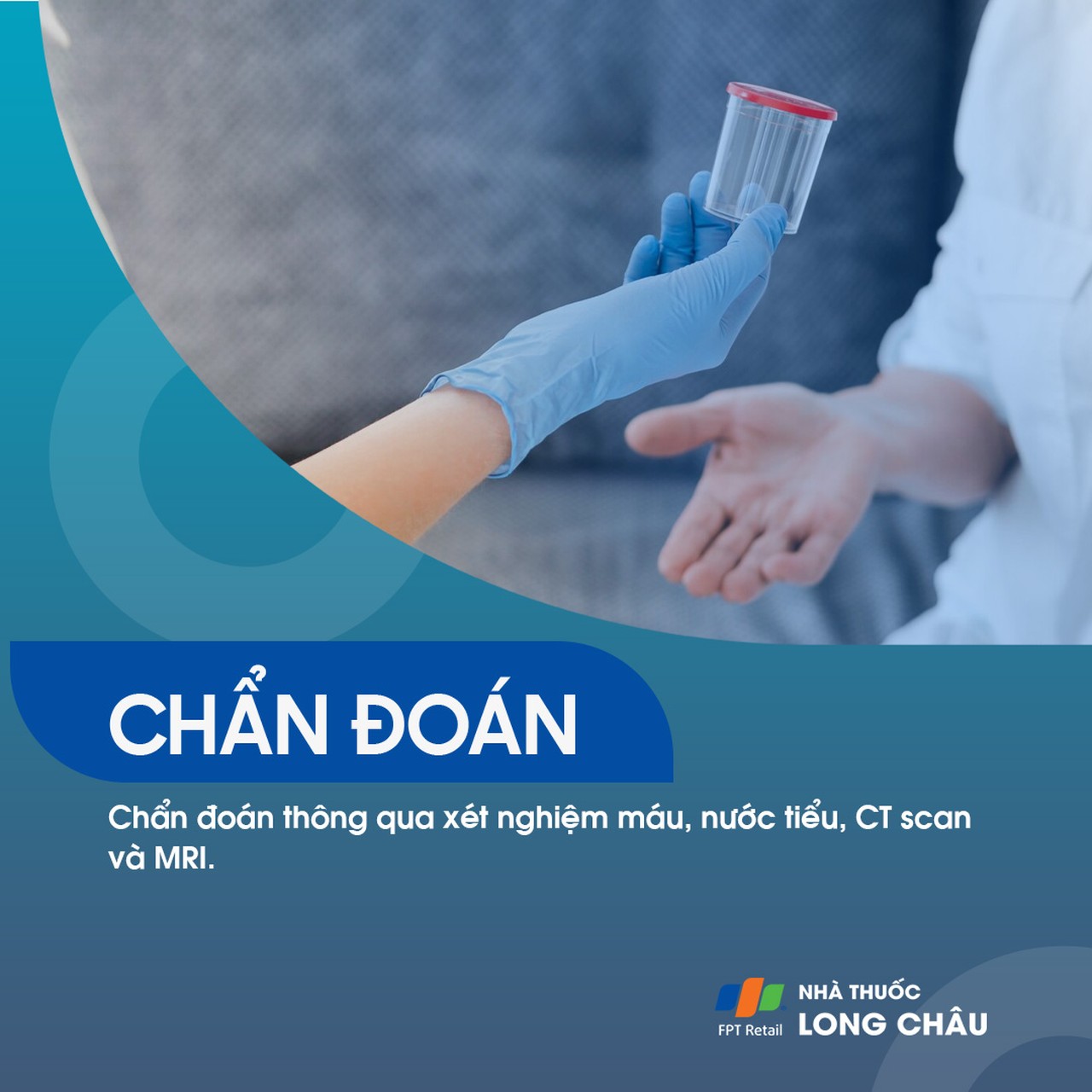 Bệnh não Wernicke 5