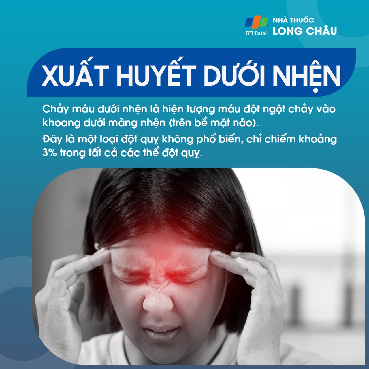 Xuất huyết dưới nhện 1