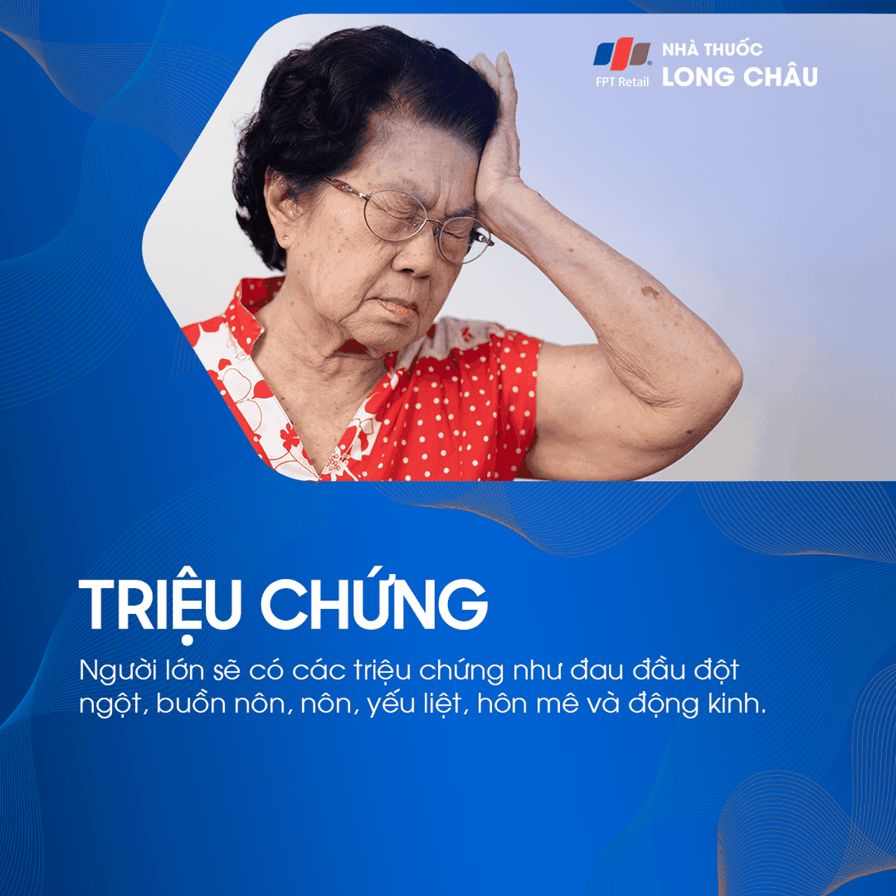 Xuất huyết não thất 2