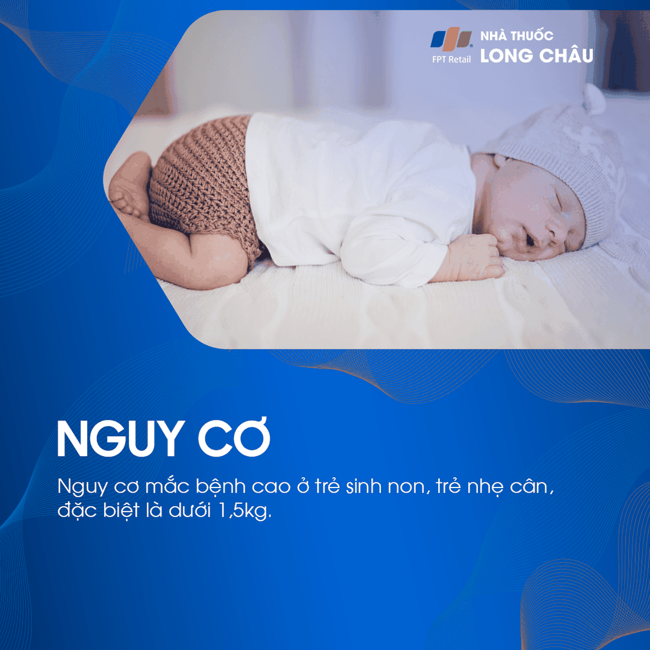 Xuất huyết não thất 6