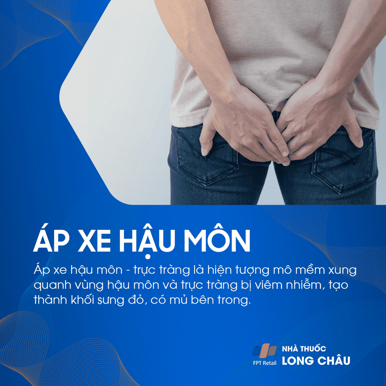 Áp xe vùng hậu môn 1