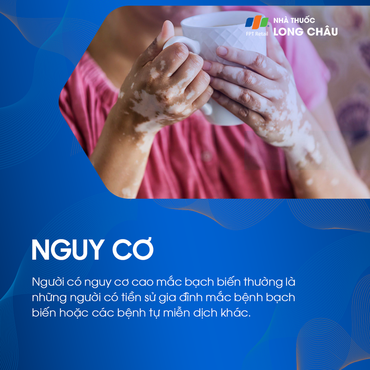 Người có tiền sử gia đình bị bạch biến hoặc bệnh tự miễn có nguy cơ cao mắc bệnh