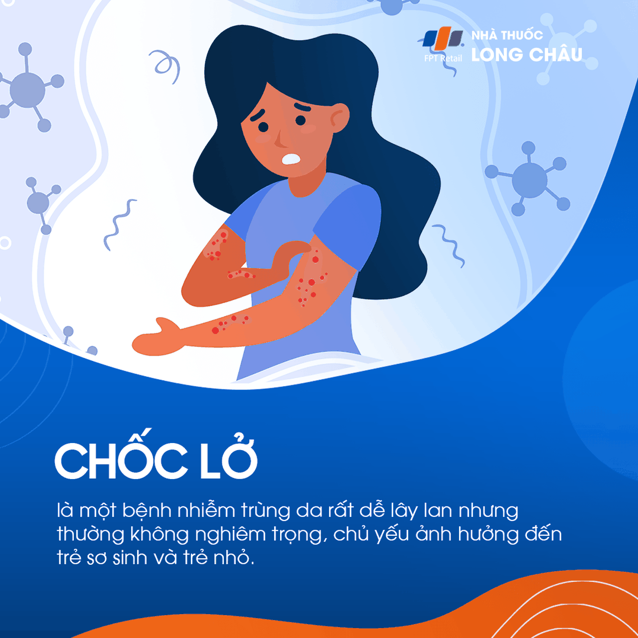 Chốc lở là bệnh nhiễm trùng da dễ lây, chủ yếu gặp ở trẻ sơ sinh và trẻ nhỏ nhưng thường không nghiêm trọng