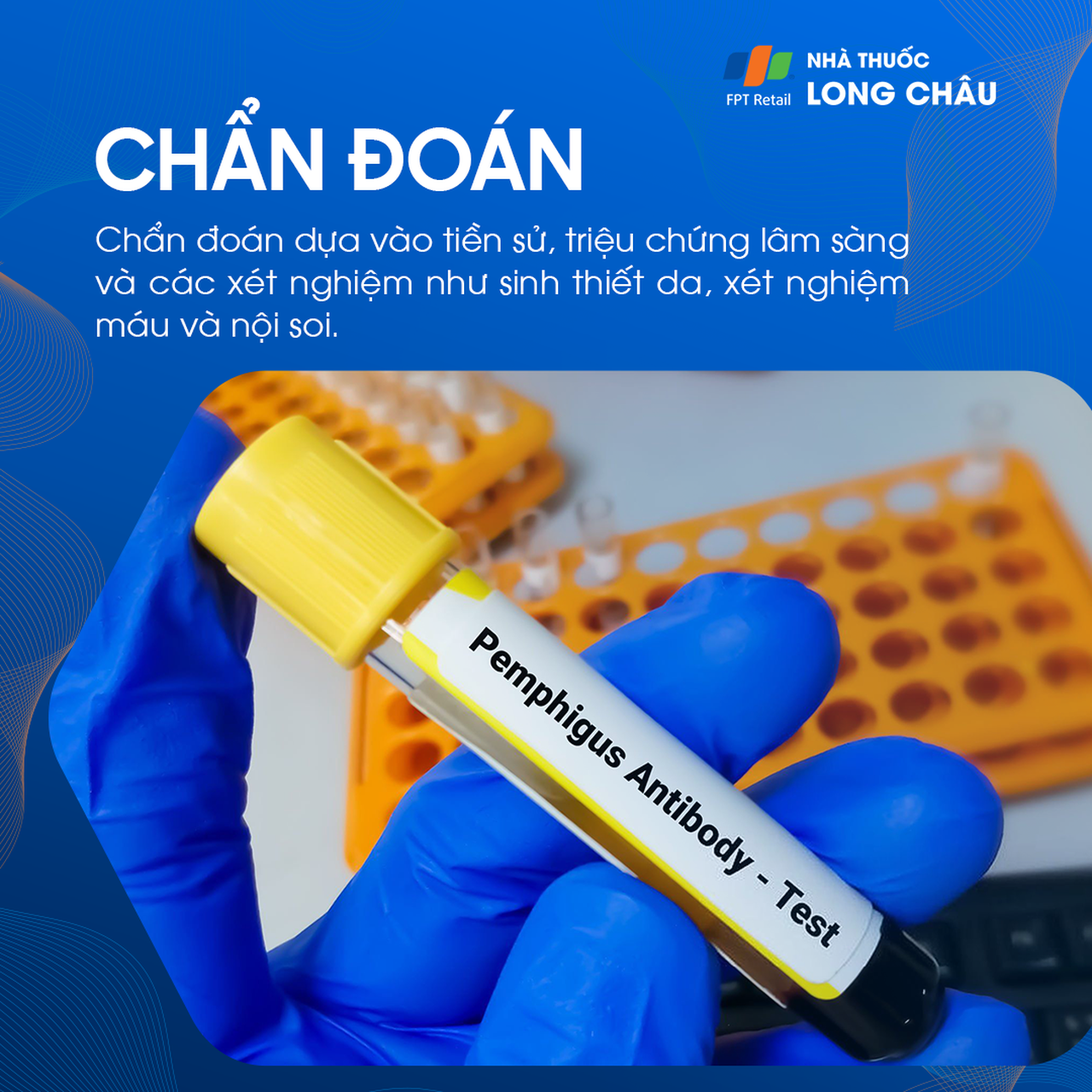 Da bọng nước tự miễn Pemphigus 5