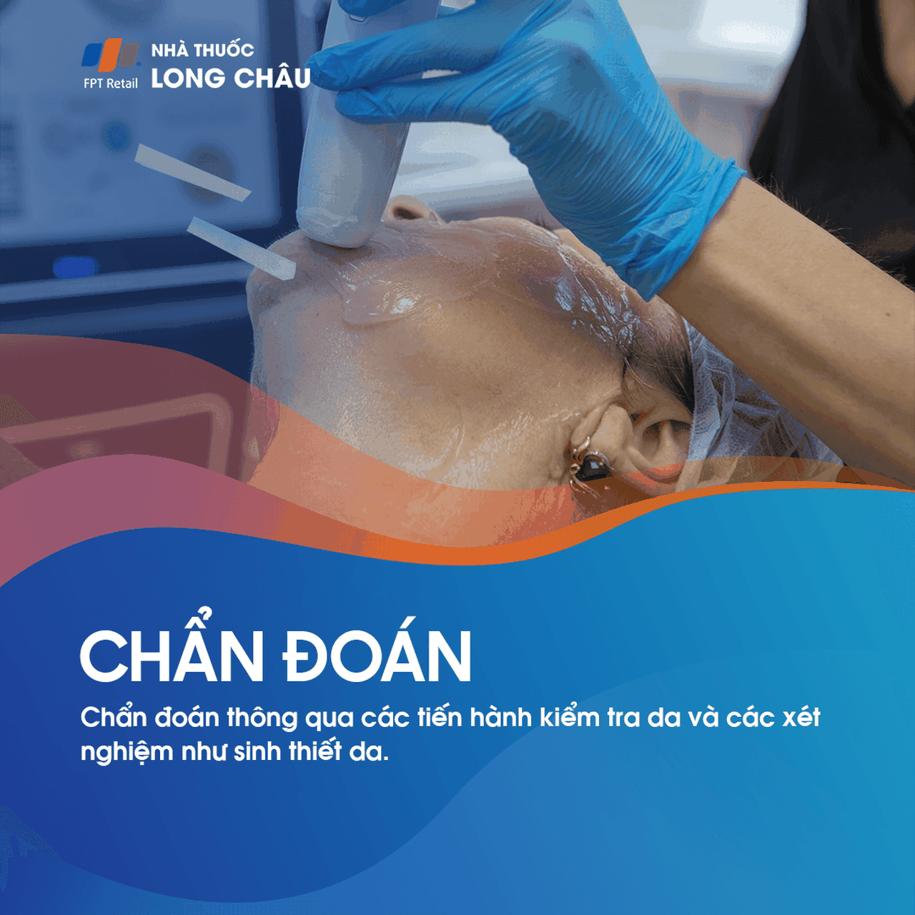 Dày sừng ánh sáng 5