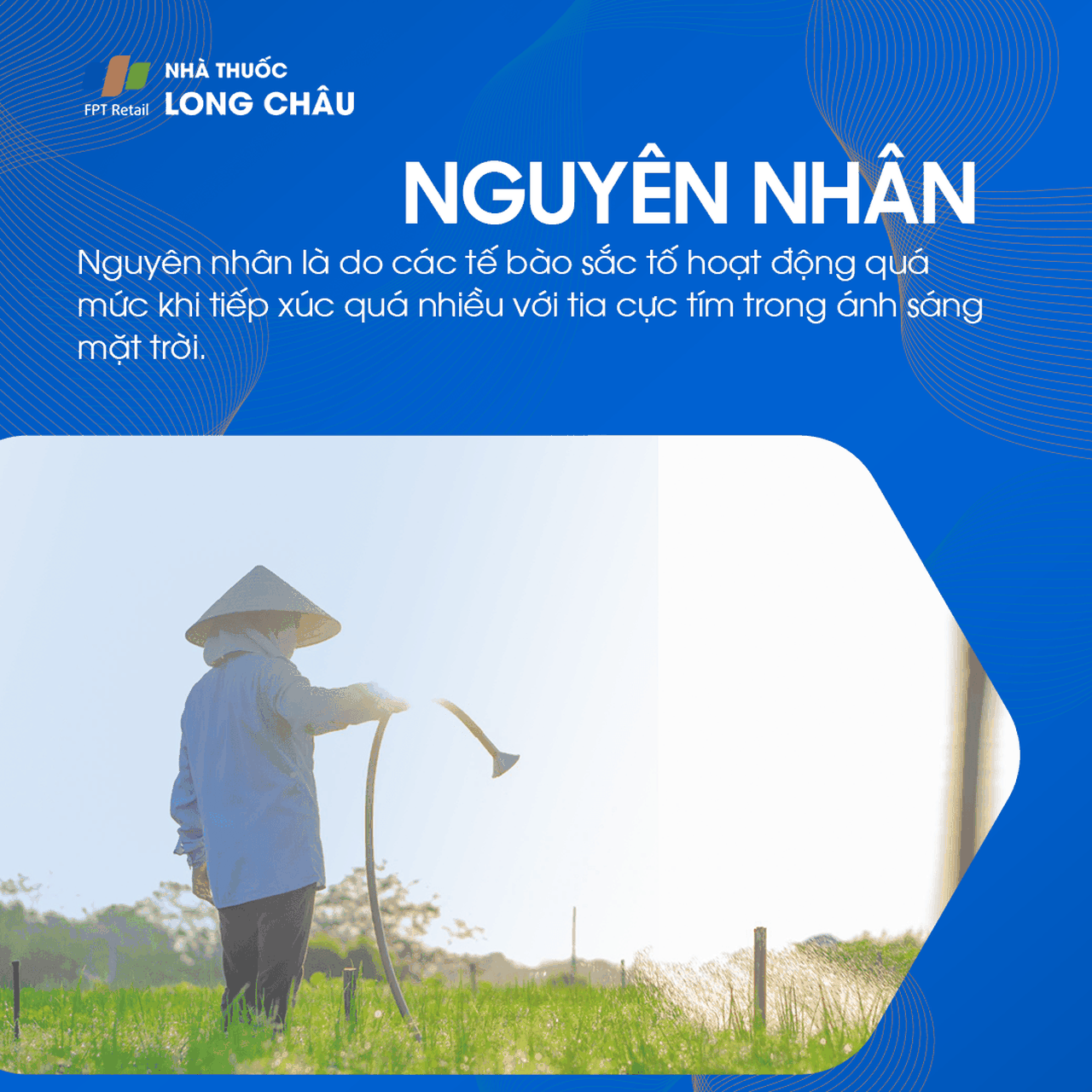 Nguyên nhân gây đồi mồi bao gồm tiếp xúc lâu dài với ánh nắng mặt trời, thay đổi hormone và yếu tố di truyền