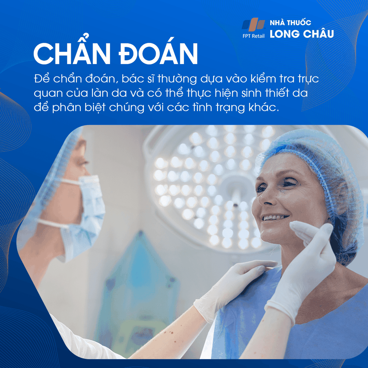 Cách chẩn đoán đồi mồi thường dựa vào khám ngoại khoa da liễu và đánh giá lâm sàng về mức độ và mẫu phân bố của các vết sắc tố