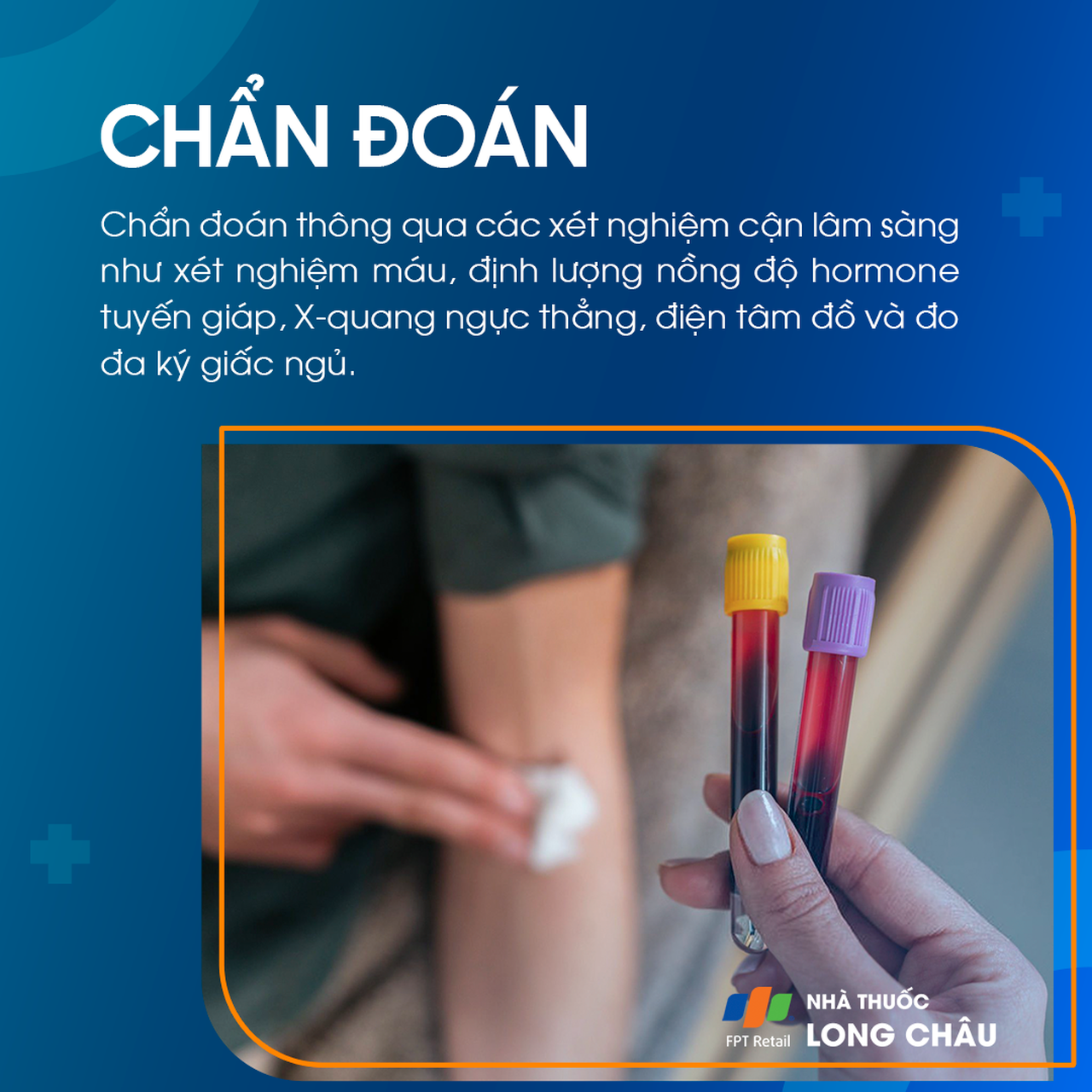 Đổ mồ hôi trộm 5