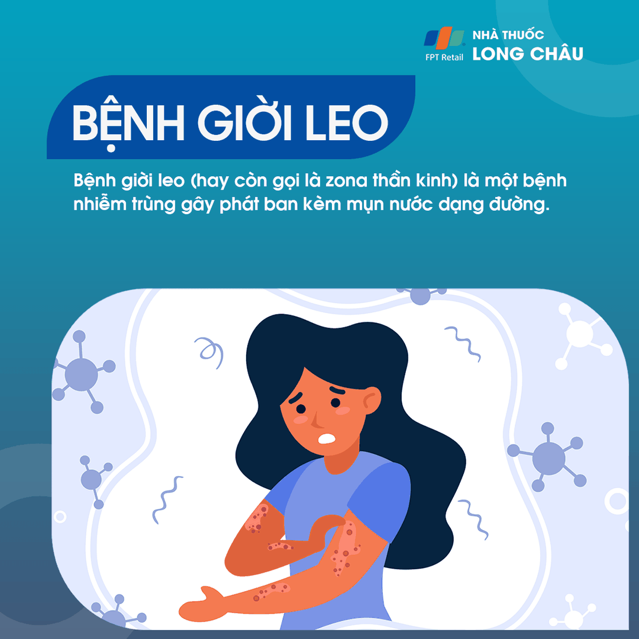 Giời leo là gì? Những vấn đề cần biết về bệnh giời leo