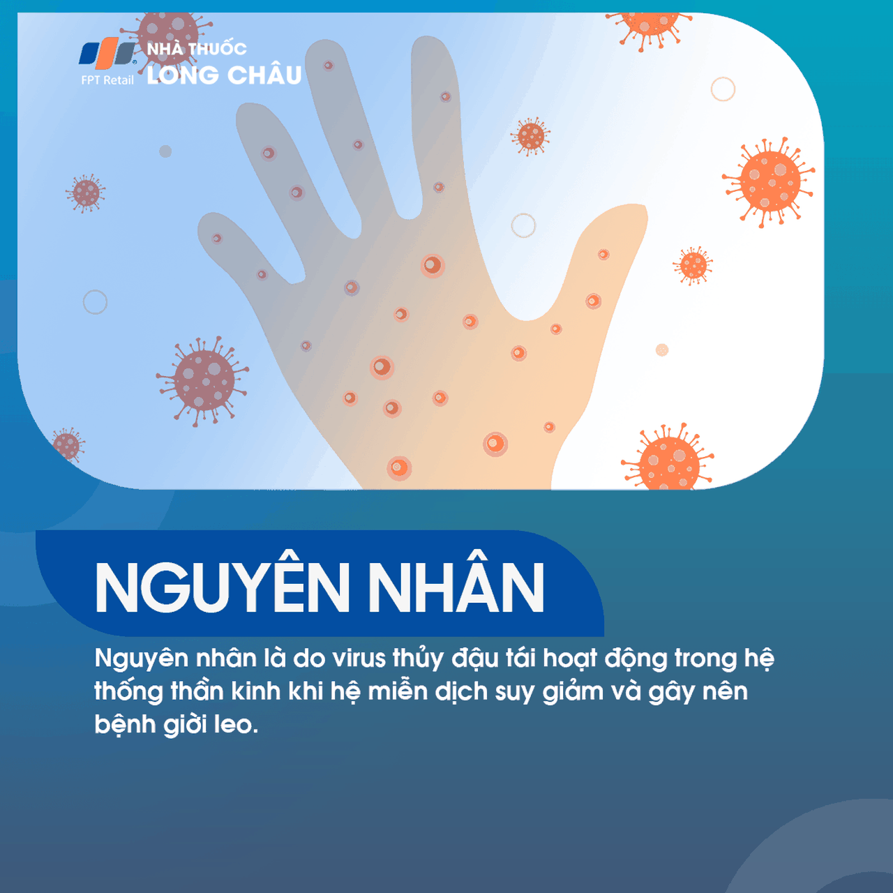 bệnh giời leo, thường liên quan đến sự tái hoạt động của virus varicella-zoster ở người đã từng mắc thủy đậu
