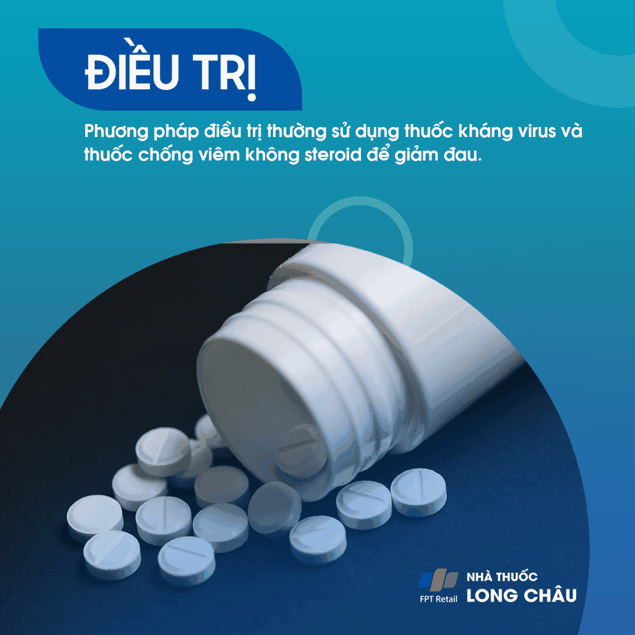 điều trị bệnh giời leo với thuốc kháng virus và các loại thuốc giảm đau để kiểm soát các triệu chứng