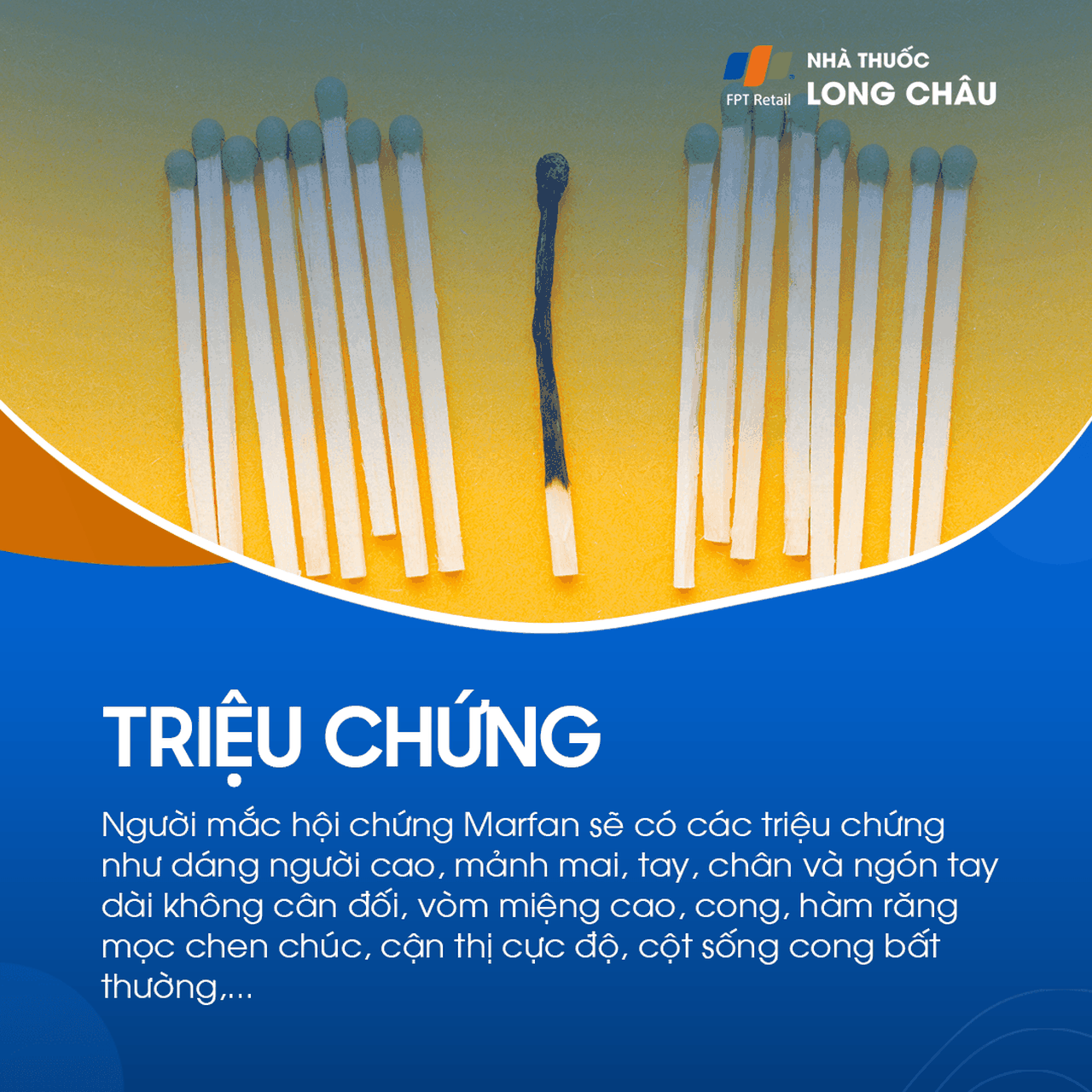 Hội chứng Marfan 2