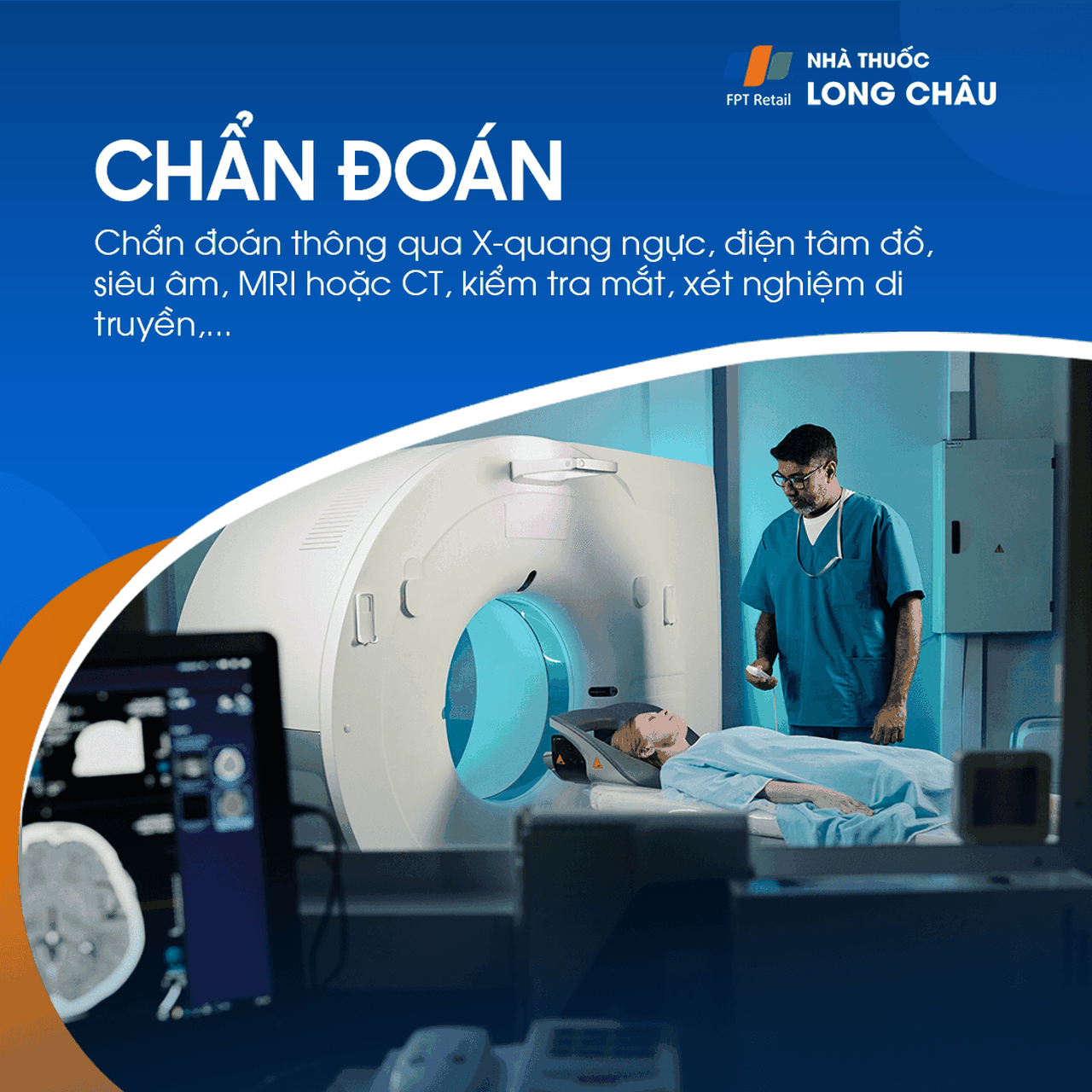 Hội chứng Marfan 4