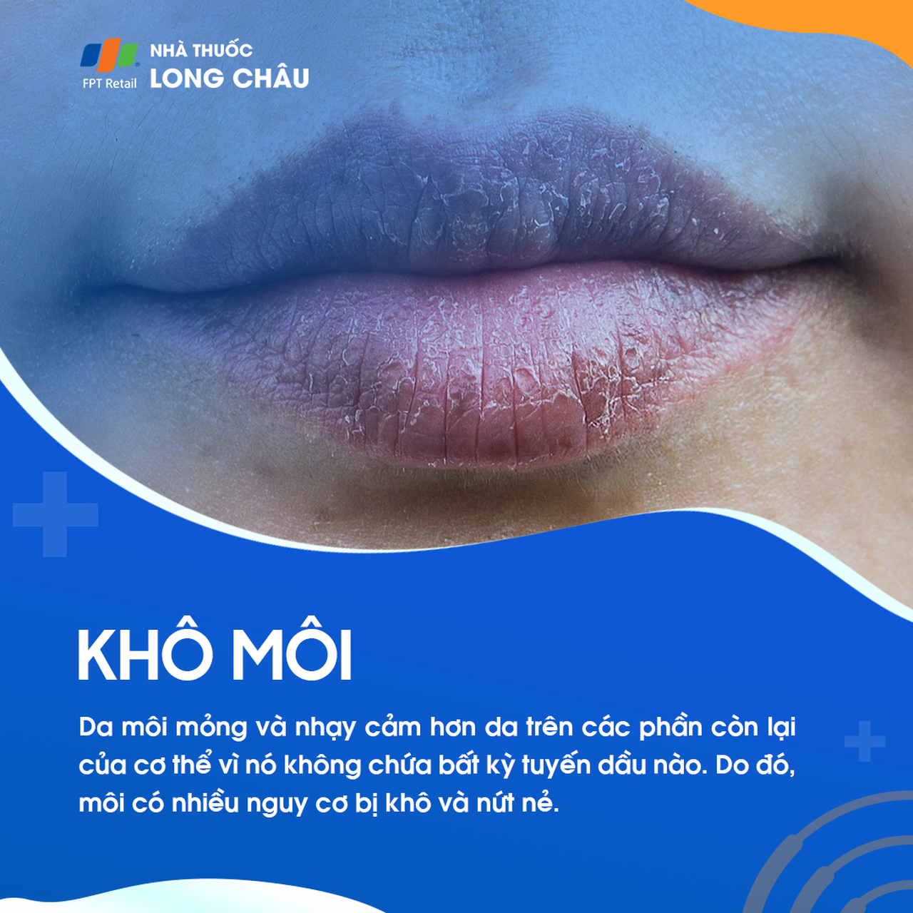 Khô môi có thể xảy ra khi môi tiếp xúc với chất gây dị ứng, do thời tiết thay đổi hoặc do tình trạng sức khỏe.