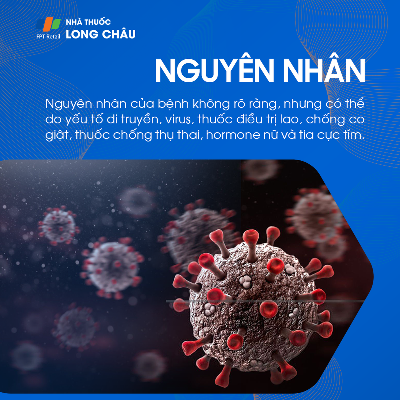 Virus là yếu tố khởi phát lupus ban đỏ