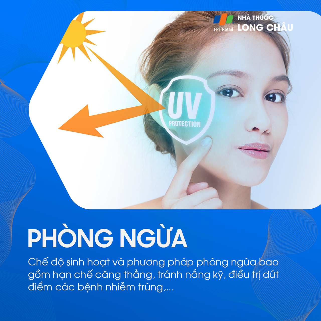Tránh nắng là biện pháp phòng ngừa lupus ban đỏ