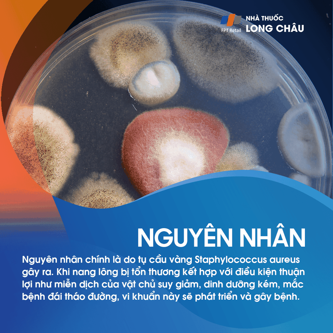 Nguyên nhân hình thành mụn nhọt thường liên quan đến nhiễm trùng vi khuẩn