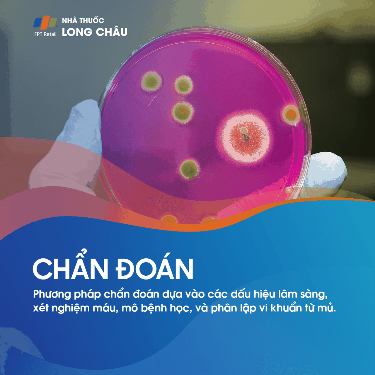 Quá trình chẩn đoán bệnh mụn nhọt bằng cách lấy mẫu từ các nốt mụn để xét nghiệm