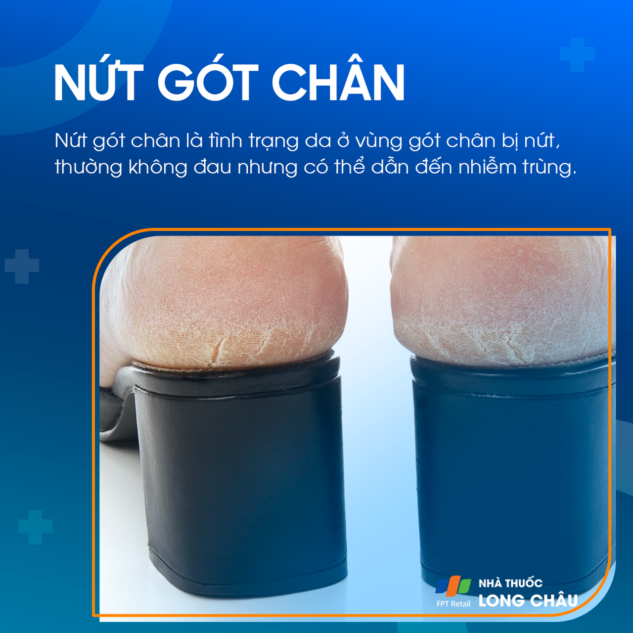 Nứt Gót Chân 1