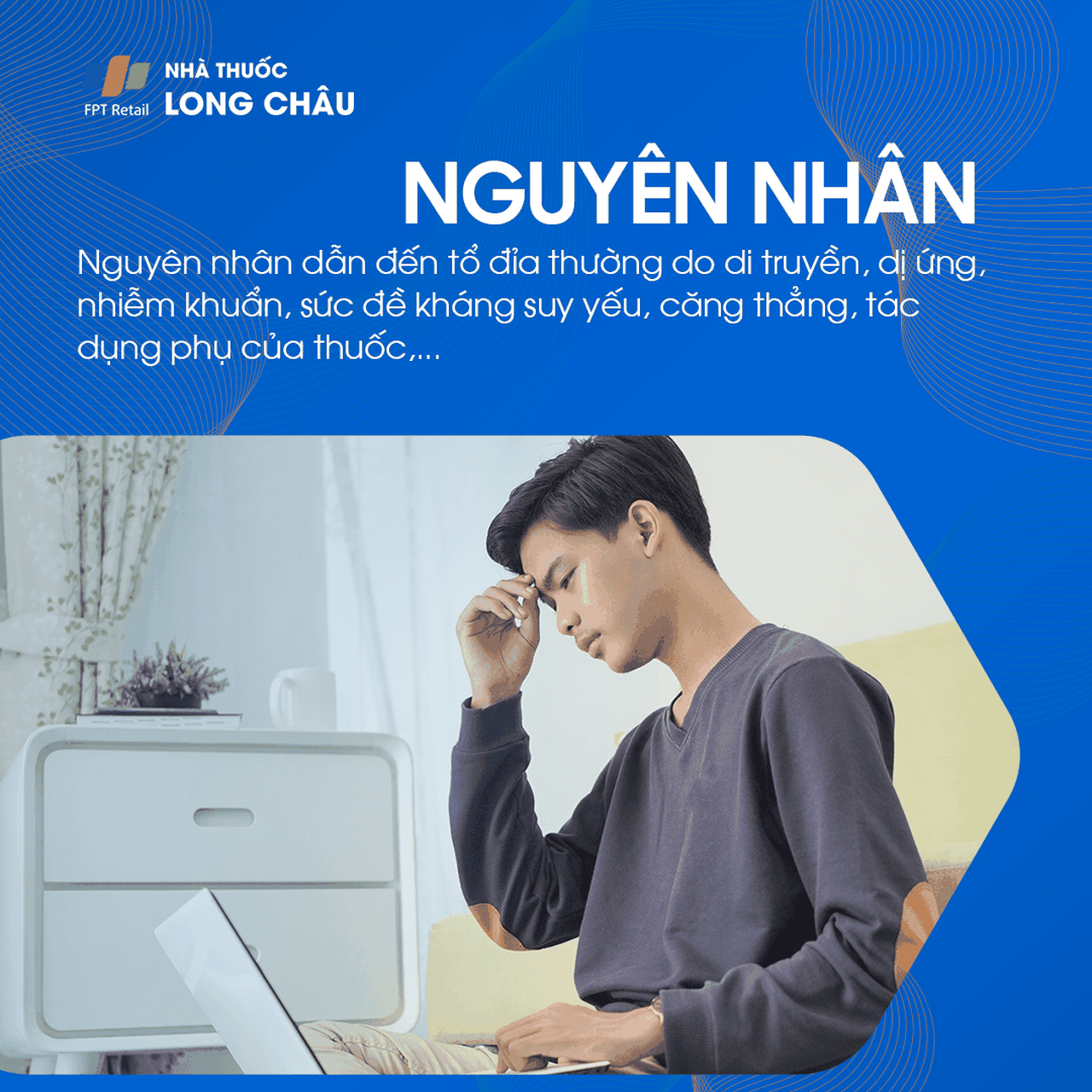 Nguyên nhân gây bệnh tổ đỉa có thể do di truyền, phản ứng miễn dịch thái quá, hoặc tác động từ môi trường