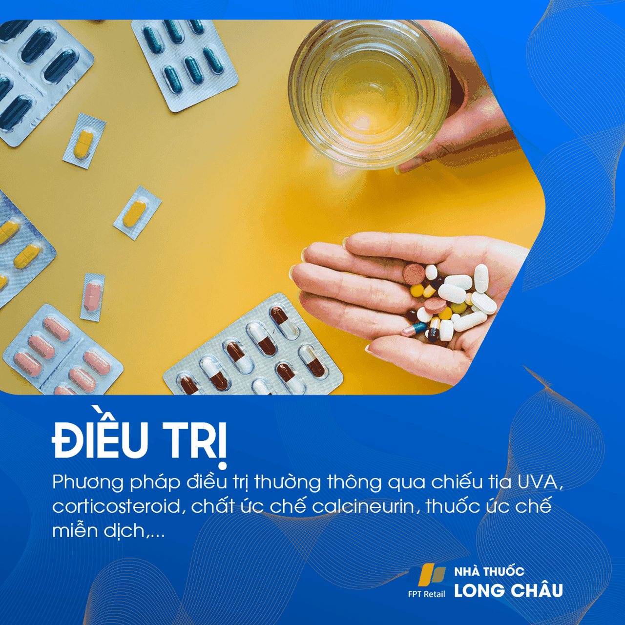 Điều trị bệnh tổ đỉa bằng cách sử dụng kem bôi steroid để giảm viêm và ngứa