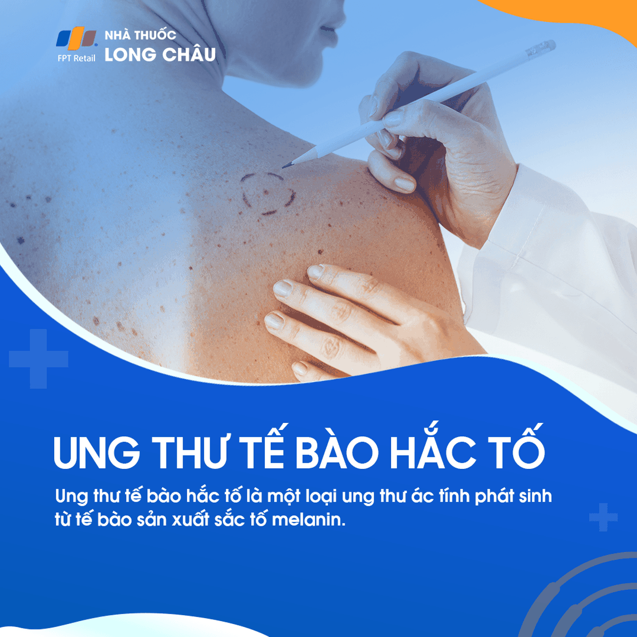 Ung Thư Tế Bào Hắc Tố 1