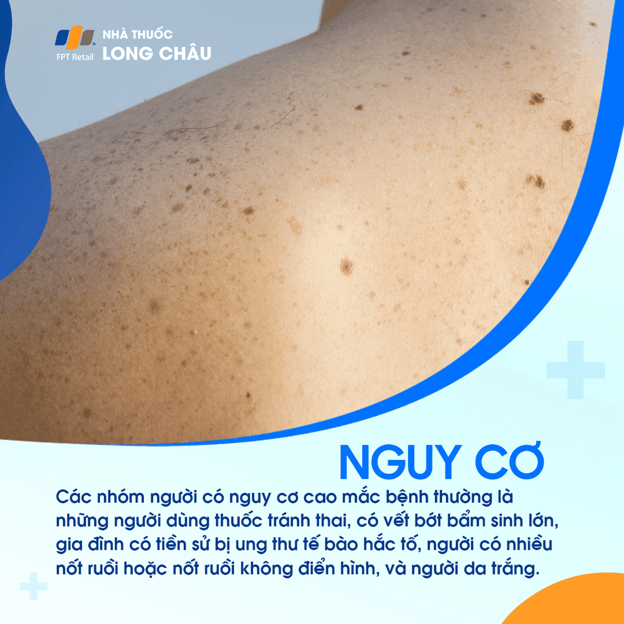 Ung Thư Tế Bào Hắc Tố 4