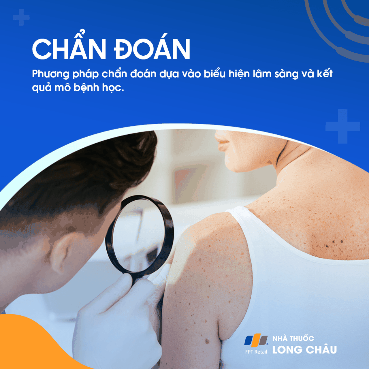 Ung Thư Tế Bào Hắc Tố 5