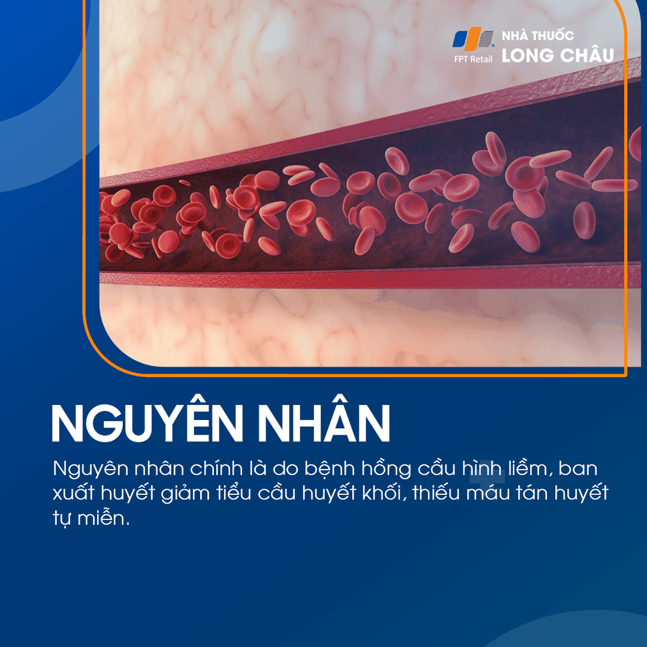 Vàng da tán huyết 3